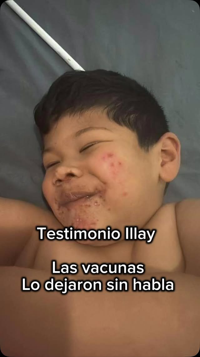 Más relatos de papás sobre cambios en sus hijos después de vacunar